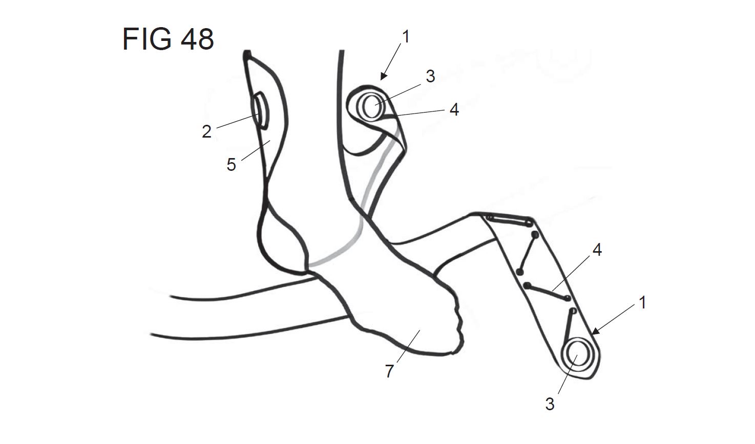 WINCH Drawing
