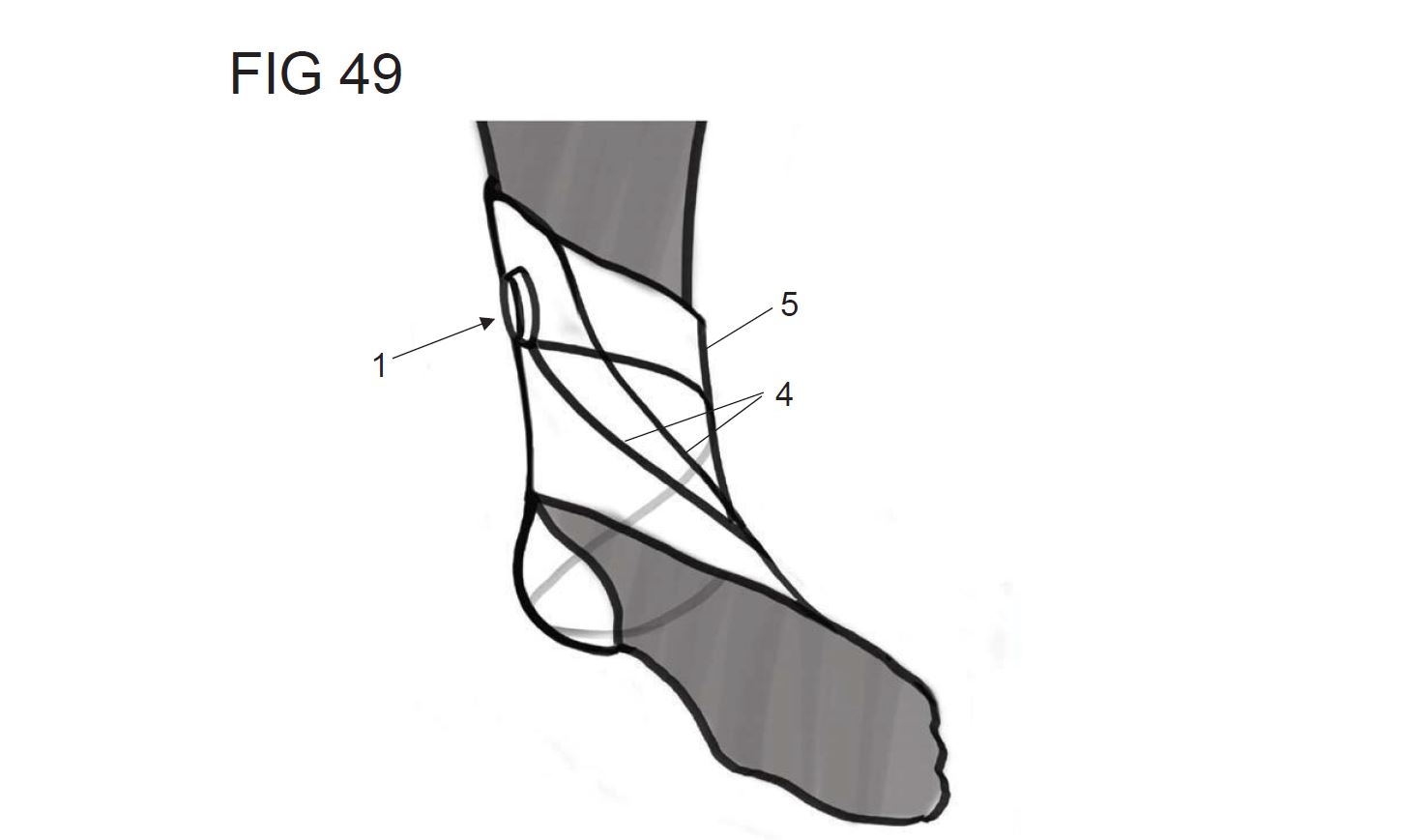 WINCH Drawing